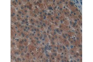 Used in DAB staining on fromalin fixed paraffin- embedded liver tissue (PTPN12 抗体  (AA 1-293))