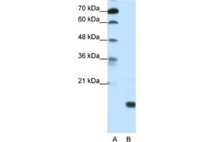 Western Blotting (WB) image for anti-TGFB-Induced Factor Homeobox 2-Like, Y-Linked (TGIF2LY) antibody (ABIN2461298) (TGIF2LY 抗体)