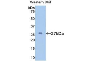 Detection of Recombinant a1BG, Mouse using Polyclonal Antibody to Alpha-1-B-Glycoprotein (a1BG) (A1BG 抗体  (AA 313-512))