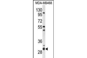 Western blot analysis of PSMG2 Antibody (C-term) (ABIN653651 and ABIN2842992) in MDA-M cell line lysates (35 μg/lane). (PSMG2 抗体  (C-Term))