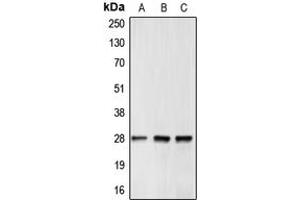 Western blot analysis of BCL2 expression in MCF7 (A), mouse brain (B), rat kidney (C) whole cell lysates. (Bcl-2 抗体  (Center))