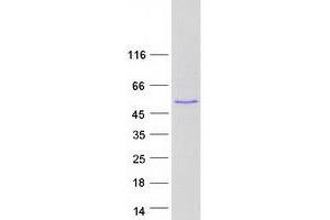 Western Blotting (WB) image for Actin Binding LIM Protein Family, Member 2 (ABLIM2) (Transcript Variant 7) protein (Myc-DYKDDDDK Tag) (ABIN2715704)