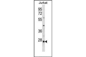 Western blot analysis of HTATIP2 Antibody (N-term) in Jurkat cell line lysates (35ug/lane). (HIV-1 Tat Interactive Protein 2, 30kDa (HTATIP2) (AA 44-74), (N-Term) 抗体)