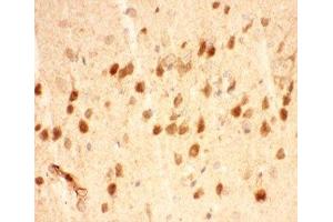 IHC-P testing of mouse brain tissue (BDNF 抗体  (AA 129-247))