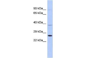 WB Suggested Anti-SAR1B Antibody Titration: 0. (SAR1B 抗体  (Middle Region))