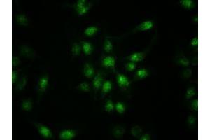 Immunofluorescent staining of HeLa cells using anti-KRT19 mouse monoclonal antibody (ABIN2452318). (Cytokeratin 19 抗体  (AA 240-390))
