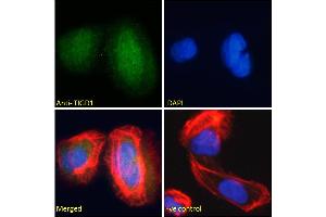 ABIN185179 Immunofluorescence analysis of paraformaldehyde fixed U2OS cells, permeabilized with 0. (TIGD1 抗体  (C-Term))