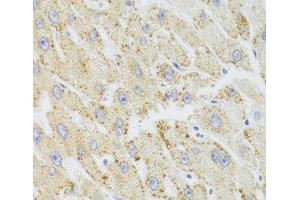 Immunohistochemistry (Paraffin-embedded Sections) (IHC (p)) image for anti-Hydroxysteroid (17-Beta) Dehydrogenase 13 (HSD17B13) antibody (ABIN7011012)