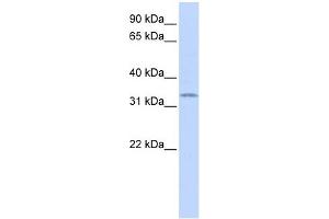 WB Suggested Anti-SOX1 Antibody Titration: 0. (SOX1 抗体  (Middle Region))