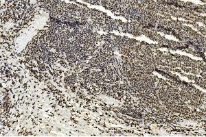 Immunohistochemical analysis of paraffin-embedded Human tonsil section using Pink1 am1836a. (EZH2 抗体)