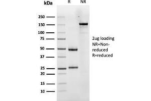SDS-PAGE Analysis Purified LHCGR Mouse Monoclonal Antibody (LHCGR/1417). (LHCGR 抗体  (AA 70-410))