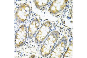 Immunohistochemistry of paraffin-embedded human colon using MyD88 Antibody (ABIN6128257, ABIN6144228, ABIN6144229 and ABIN6213986) at dilution of 1:100 (40x lens). (MYD88 抗体  (AA 60-309))