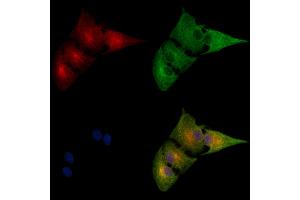 ABIN6256934 and ABIN6274825 staining  cells by IF/ICC. (ALDH3B1 抗体  (N-Term))