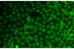 Immunofluorescence analysis of A549 cells using GADD45A Polyclonal Antibody (GADD45A 抗体)
