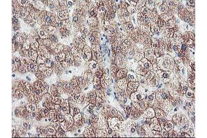 Immunohistochemical staining of paraffin-embedded Human liver tissue using anti-CYP2J2 mouse monoclonal antibody. (CYP2J2 抗体)