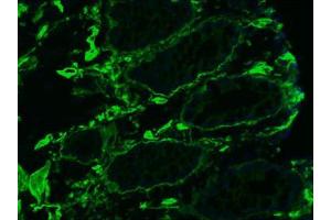 Image no. 1 for anti-Collagen, Type IV (COL4) antibody (ABIN959465) (Collagen IV 抗体)