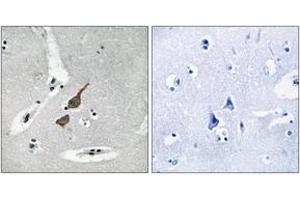 Immunohistochemistry analysis of paraffin-embedded human brain tissue, using GRID1 Antibody. (GRID1 抗体  (AA 831-880))