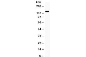 Western blot testing of human SW620 cell lysate with CDCP1 antibody. (CDCP1 抗体)