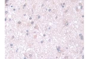 Immunohistochemistry (IHC) image for anti-Thiopurine S-Methyltransferase (TPMT) (AA 26-227) antibody (ABIN7435148)