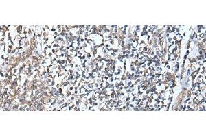 Immunohistochemistry of paraffin-embedded Human tonsil tissue using DEFB104A Polyclonal Antibody at dilution of 1:50(x200) (DEFB104A 抗体)