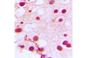 Immunohistochemical analysis of ZNF76 staining in human testis formalin fixed paraffin embedded tissue section. (ZNF76 抗体  (Center))