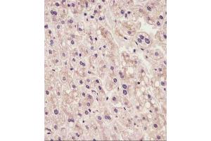 staining IL1R in human liver tissue sections by Immunohistochemistry (IHC-P - paraformaldehyde-fixed, paraffin-embedded sections). (IL1RAP 抗体  (AA 279-313))