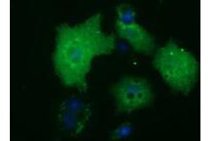 Anti-HDAC10 mouse monoclonal antibody (ABIN2453115) immunofluorescent staining of COS7 cells transiently transfected by pCMV6-ENTRY HDAC10 (RC218536). (HDAC10 抗体)
