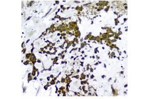 IHC analysis of NMI using anti-NMI antibody (ABIN3043451).
