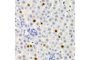 Immunohistochemistry of paraffin-embedded rat liver using GEMIN2 Antibody. (SIP1 抗体)