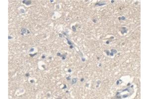 Detection of SCARA5 in Human Cerebrum Tissue using Polyclonal Antibody to Scavenger Receptor Class A Member 5 (SCARA5) (SCARA5 抗体  (AA 118-495))