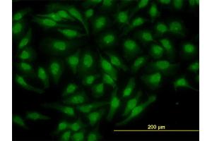 Immunofluorescence (IF) image for anti-Nuclear Receptor Subfamily 4, Group A, Member 2 (NR4A2) (AA 71-170) antibody (ABIN518477)