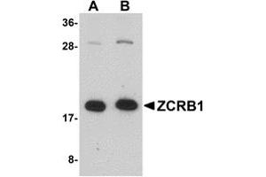 Western Blotting (WB) image for anti-Zinc Finger CCHC-Type and RNA Binding Motif 1 (ZCRB1) (C-Term) antibody (ABIN1030818) (ZCRB1 抗体  (C-Term))