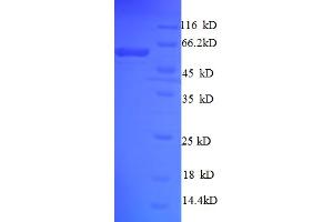 SDS-PAGE (SDS) image for SurA (AA 21-428) protein (His-SUMO Tag) (ABIN5711049) (SurA (AA 21-428) protein (His-SUMO Tag))