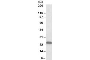 Western blot of rat kidney lysate with GM2A antibody at 0. (GM2A 抗体)