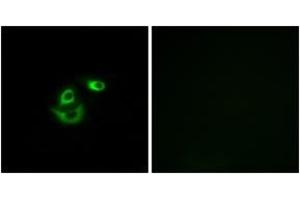 Immunofluorescence analysis of A549 cells, using CLCC1 Antibody. (CLCC1 抗体  (AA 391-440))