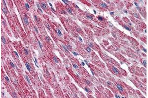 Human Heart: Formalin-Fixed, Paraffin-Embedded (FFPE) (DLD 抗体  (AA 1-510))