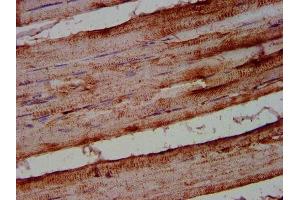 Immunohistochemistry (IHC) image for anti-Arachidonate 12-Lipoxygenase (ALOX12) (AA 508-658) antibody (ABIN7144528)