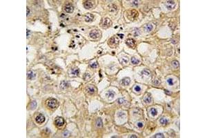 IHC analysis of FFPE human testis tissue stained with Angiotensin-converting enzyme 2 antibody