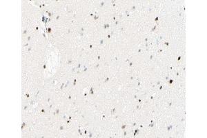 ABIN6267431 at 1/100 staining human brain tissue sections by IHC-P.