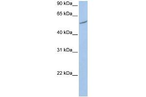 WB Suggested Anti-RIOK3 Antibody Titration:  0. (RIOK3 抗体  (C-Term))