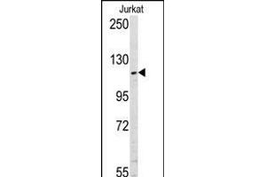 Western blot analysis of anti-USP11 Pab (ABIN388894 and ABIN2839183) in Jurkat cell line lysates (35 μg/lane). (USP11 抗体  (N-Term))