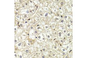 Immunohistochemistry of paraffin-embedded human liver injury using LMNB2 Antibody (ABIN5973877) at dilution of 1/200 (40x lens). (Lamin B2 抗体)
