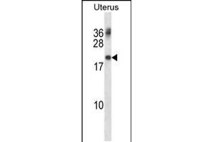 Western blot analysis in human normal Uterus tissue lysates (35ug/lane). (PMP22 抗体  (AA 102-130))