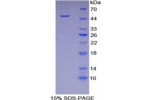 SDS-PAGE analysis of Human Fetuin B Protein.