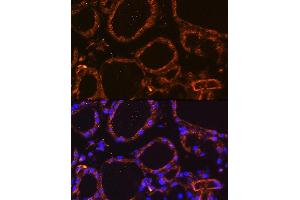 Immunofluorescence (IF) image for anti-Wingless-Type MMTV Integration Site Family, Member 5A (WNT5A) (AA 250-350) antibody (ABIN6150248)