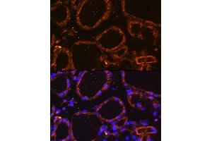 Immunofluorescence analysis of Mouse thyroid using WNT5A Rabbit pAb (ABIN6134458, ABIN6150248, ABIN6150249 and ABIN6216485) at dilution of 1:100. (WNT5A 抗体  (AA 250-350))