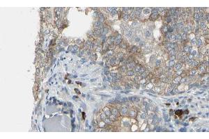 ABIN6274616 at 1/100 staining Human prostate tissue by IHC-P. (CDCA3 抗体  (C-Term))