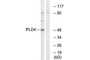 Western blot analysis of extracts from Jurkat cells, using PLD4 Antibody. (Phospholipase D4 抗体  (AA 457-506))