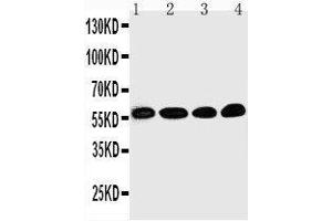 Anti-Egr1 antibody, Western blotting Lane 1: Rat Brain Tissue Lysate Lane 2: HELA Cell Lysate Lane 3: MCF-7 Cell Lysate Lane 4: COLO320 Cell Lysate (EGR1 抗体  (N-Term))