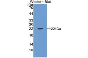 Detection of Recombinant vWF, Rat using Polyclonal Antibody to Von Willebrand Factor (vWF) (VWF 抗体  (AA 49-230))
